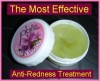 Acne Rosacea Treatment Eliminate Redness Age Spots NEW 